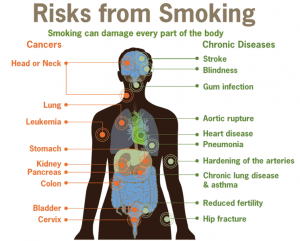 Neues aus der Welt der Medizin: Wie gibt man Rauchen auf?