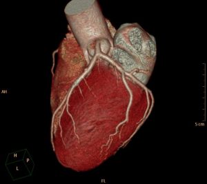 Neues aus der Welt der Medizin: Sauerstoff auf Intensivstation/Koronare Herzkrankheit diagnostizieren