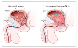Neues aus der Welt der Medizin: Prostata-Vorsorgeuntersuchung schädlich?