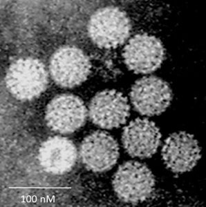 Papilloma Virus (HPV) EM (new Version)